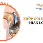 thu tuc nhap khau khop goi nhan tao