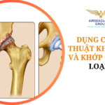 thu tuc nhap khau khop goi