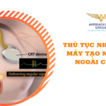 thu tuc nhap khau may tao nhip tim ngoai co the