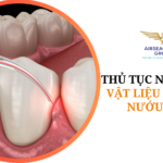 thu tuc nhap khau vat lieu chuan bi nuou rang