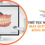 thu tuc nhap khau may quet lay dau rang