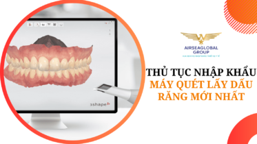 thu tuc nhap khau may quet lay dau rang