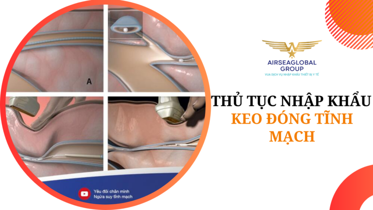thu tuc nhap khau keo dong tinh mach