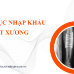THỦ TỤC NHẬP KHẨU ĐINH NẸP VÍT XƯƠNG