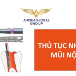 thu tuc nhap khau mui noi nha