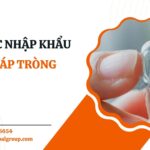 KÍNH ÁP TRÒNG